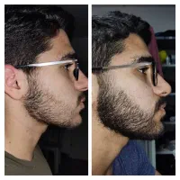 هنوز ریشات در نیومده