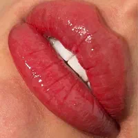 تخفیف ویژه /شیدینگ لب /درمان تیرگی لب