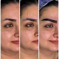 کاشت ابرو طبیعی