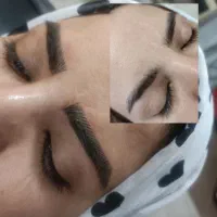 فیبروز.شیدینگ لب(نمونه کار واقعی+۵۰ درصد تخفیف)
