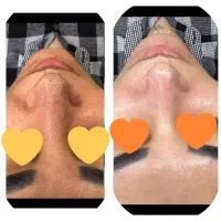 فشیال و پاکسازی۴۰۰ تخفیف ویژه