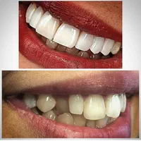 جشنواره کامپوزیت و درمانی