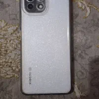 شیاومی mi11لایت5G