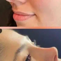 تمام جراحی های زیبایی و اموزش