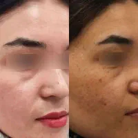 کرم سفید کننده دائمی
