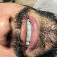 دندانپزشکی ماه دنتال|خدمات آرایشگری و زیبایی|تهران, نارمک جنوبی|دیوار
