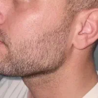 تخفیف افتتاحیه خدمات زیبایی از ۲۵۰۰ فقط ۱۸۰۰
