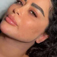 ساکشن غبغب