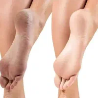 کرم  مراقبت پا