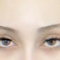 کاشت مژه