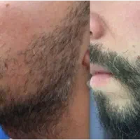 با کمترین هزینه بهترین نتیجه رو کسب کن