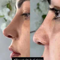 تخفیف ویژه بر روی عروس و کراتین و‌کلیه خدمات