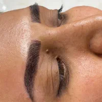 تخفیف ویژه فیبروز ابرو