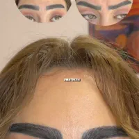 بوتاکس مصپورت