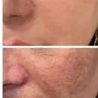 پرچمدار کرم های ضد لک(تعداد محدود)