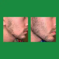 خاص شو|آرایشی، بهداشتی، درمانی|نورآباد, |دیوار