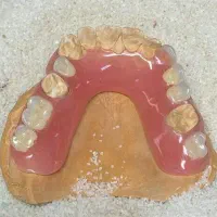 دندانسازی هاله
