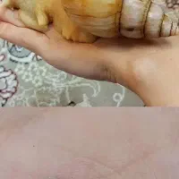 حلزون آلبینو