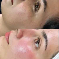 تخفیفات 50%پاکسازی پوست، بافت مو ،لیفت ابرو