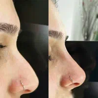 دماغتو تبدیل به بینی کن