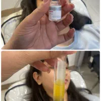 جشنواره تزریق فیلر وبوتاکس و پی آر پی وفشیال پزشک