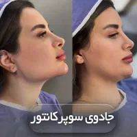 ساکشن تخصصی غبغب و بلفارو پلاستی چشم