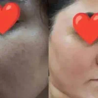 صابون سفیدکننده جهانی