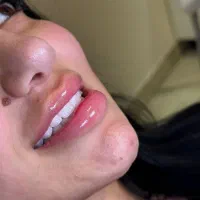 کامپوزیت لبه شیشه ای واحدی ۳۵۰۰