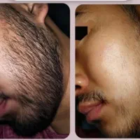 ریش دار شو