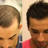معجزه رویش
