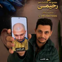 کاشت مو رحیمی. نامی آشنا در ایران. (تبریز)