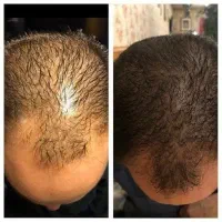 یه نفس تازه برای موهای خسته
