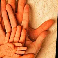 پذیرش تخمک اهدایی