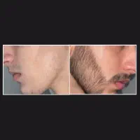 اینو بزن ریشات جنگلی میشه...