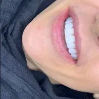 خدمات دندانپزشکی با مناسب ترین تعرفه،بهترین کیفیت