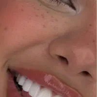 کامپوزیت افر ویژه فقط تا ۲۵ ام