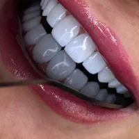 به یک منشی خانم جهت کار در دندانسازی نیازمندیم