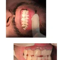خدمات دندانپزشکی