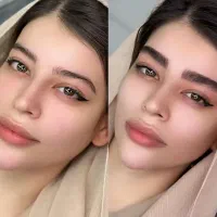 فیبروزبه سبک(کرکی مویی).بنمژه.شیدینگ لب