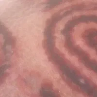 نمد