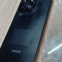 Honor x7c  گارانتی دار