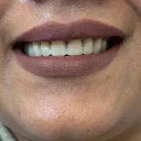 دندان مصنوعی دندانسازی اقساط