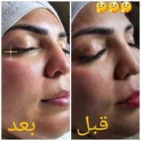 پاکسازی و فشیال تخصصی ۳۸۰هزارتومن