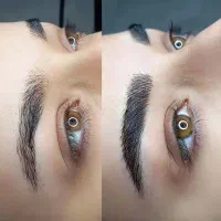 آف میکروبلیدینگ تعداد و مدت محدود