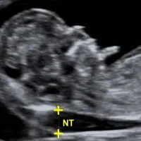 استخدام  ماما مطب  فوق تخصصی زنان وزایمان