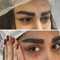 کاشت ابرو -نوبت فروردین-با اقساط