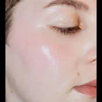 کرم سفید کننده صورت 10درجه سفیدی تضمینی