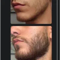 ریش پرپشت اینم فرمولش