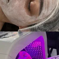 پاکسازی تخصصی پوست و لیفت ابرو