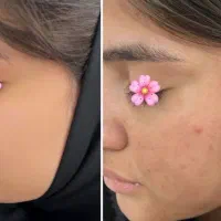 برای مشکل پوستت چه محصولی مناسبه